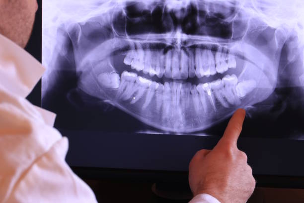 Best Emergency Treatment for Toothache in Tn Lakes, WI
